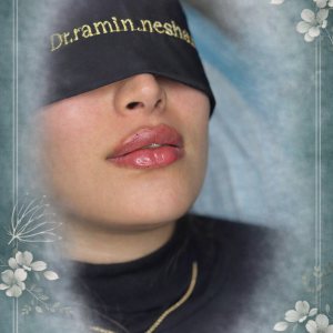 تزریق فیلر لب دکتر رامین نشسته در سقز